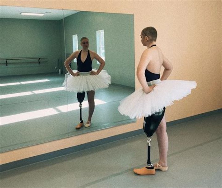 
21-Year-Old Dance Major Continues Ballet Following Bone Cancer, Leg Amputation: ‘I Never Gave Up’ 