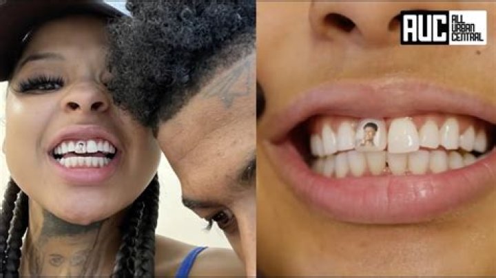 Chrisean Rock Is Blueface Girlfriend With Missing Tooth – How Old Is She?