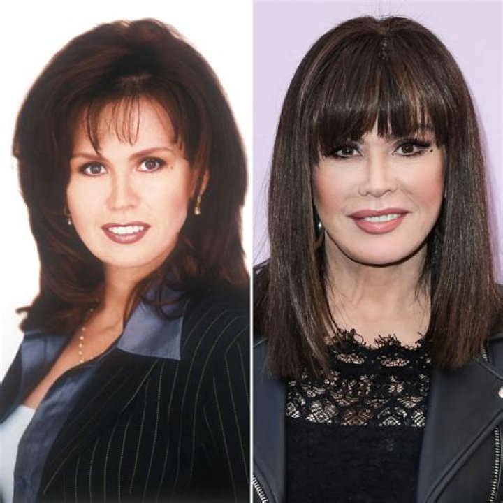 Marie Osmond Fans Accuse Her of Plastic Surgery: ‘You Look Like Kim Kardashian’: Transformation Photos