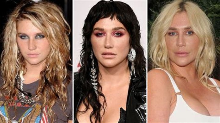 From ‘Tik Tok’ to Today! See Kesha’s Total Transformation Over the Years in Photos