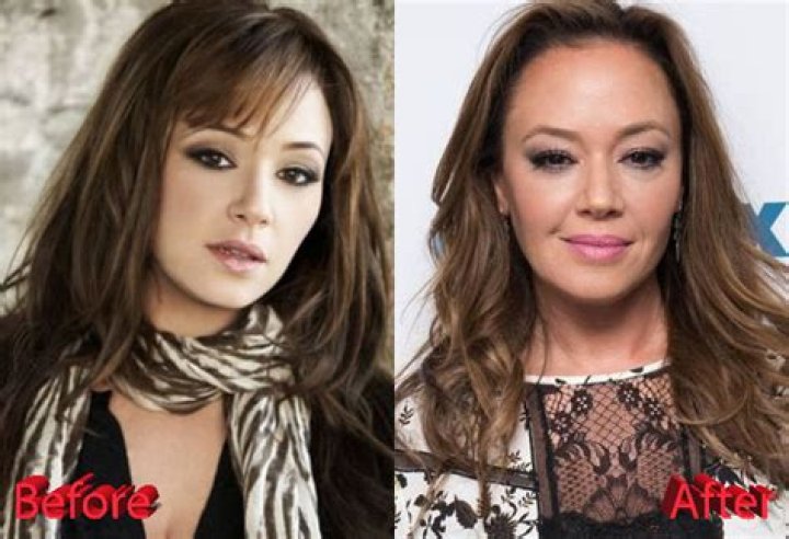 Leah Remini Credits Botox (Not Scientology) for Her Age-Defying Transformation