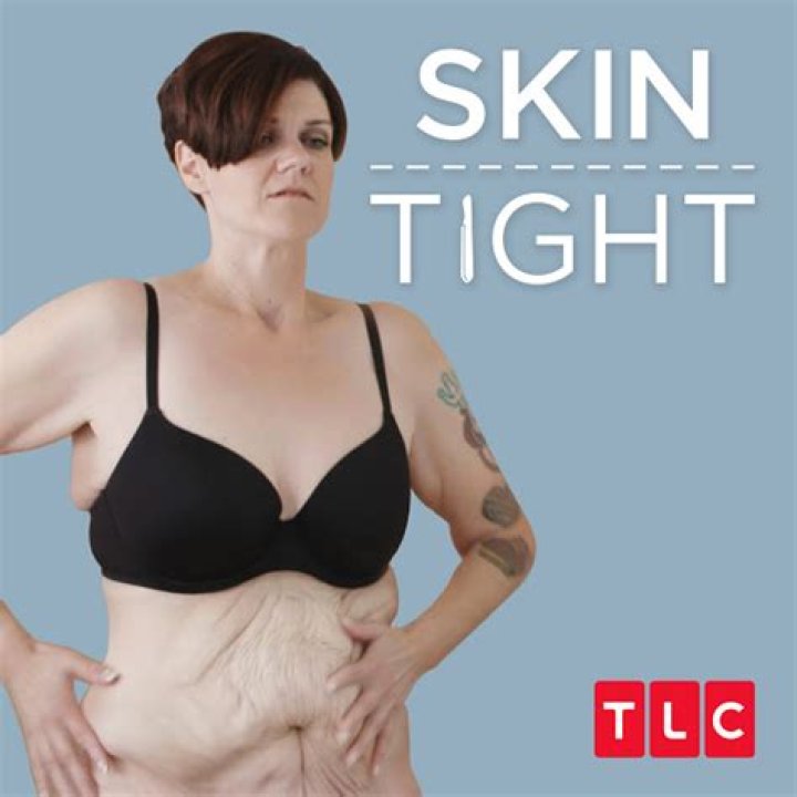 The Stars of ‘My 600-lb Life: Skin Tight’ Season 3 Lost a Total of 6,818 Pounds