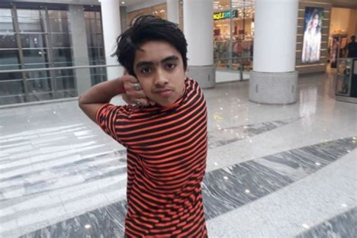 14-Year-Old "Human Owl" Can Turn His Head 180 Degrees [VIDEO]