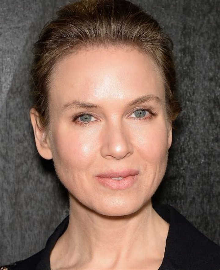 Plastic Surgery?See Reneé Zellweger’s Shocking Transformation Right Before Your Eyes