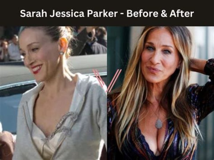 Has ‘AJLT’ Star Sarah Jessica Parker Had Plastic Surgery? See Transformation Photos, Quotes
