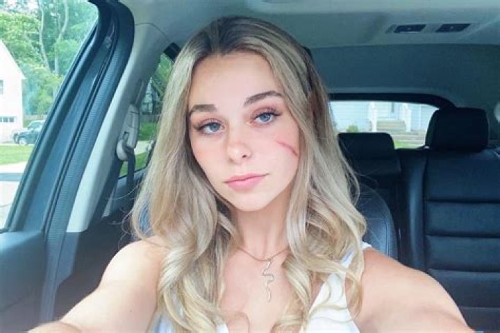 Who is Scar Girl? Wiki, Age, Height, Boyfriend, Family, Net Worth, Biography & More